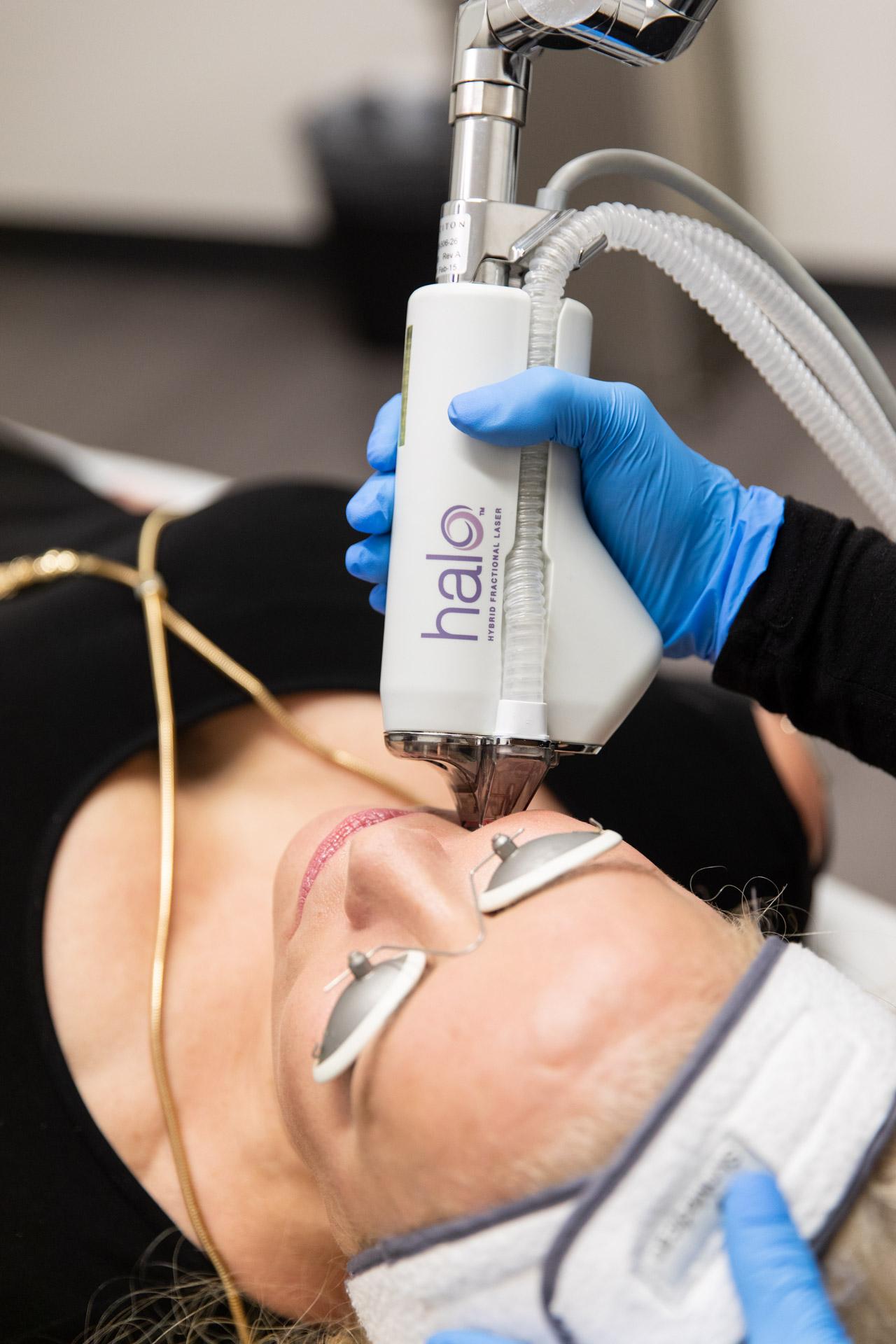 Why I’m So Excited to Introduce the HALO Laser Treatment at The Skin Lab Brisbane