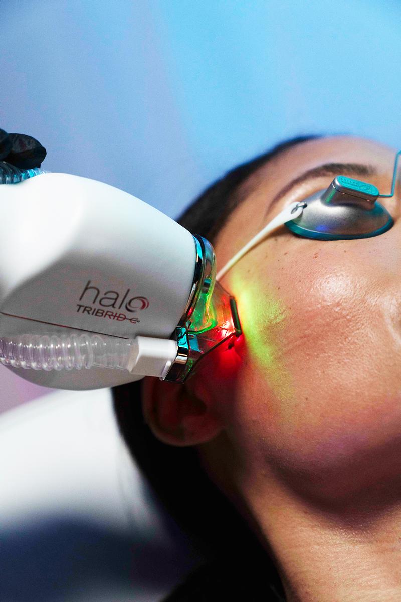 BBL, MOXI, HALO, or TRIBRID: Which Laser Treatment Is Right for Your Skin?